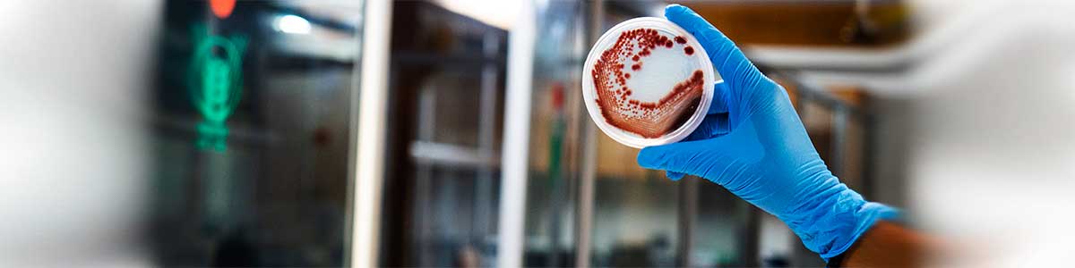 Soil Test analysis